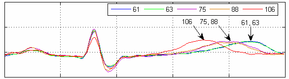 [heart rate influence]