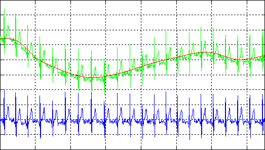 [wavelet drift correction]