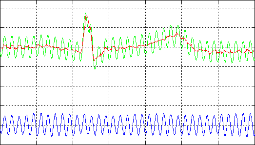 [ECG filtering 1]