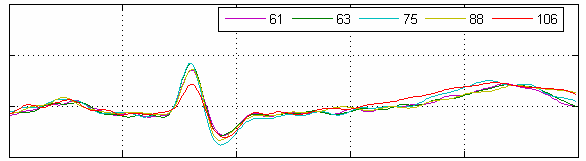 [heart rate correction]