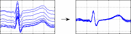 [vertical shift correction]