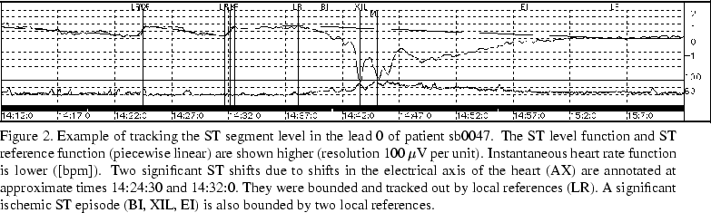 \begin{figure*}%% 89 488 563 571 40mm 31.1 mm 2.96mm
{\centering\epsfig{file=fig...
..., XIL, EI) is
also bounded by two local references.
\vspace*{-4mm}
\end{figure*}